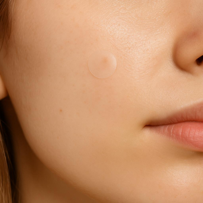 Clear Pimple Patches (36 pcs)